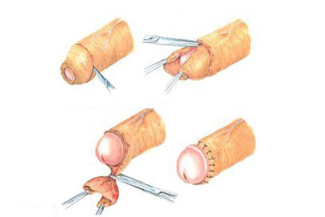 UROLOGISTA EM CURITIBA, LITÍASE URINÁRIA CURITIBA, HIPERPLASIA CURITIBA, TRATAMENTO DE CÂNCER UROLÓGICO CURITIBA, LITOTRIPSIA CURITIBA, PRÓTESE PENIANA CURITIBA, DISFUNÇÃO ERÉTIL EM CURITIBA, INPLANTE PENIANO EM CURITIBA, VARICOCELE EM CURITIBA, EJACULAÇÃO PRECOCE EM CURITIBA, ANDROPAUSA EM CURITIBA, REVISÃO DE VASECTOMIA EM CURITIBA, CURVATURA PENIANA EM CURITIBA, INFERTILIDADE MASCULINA EM CURITIBA, POSTECTOMIA EM CURITIBA, LITÍASE URINÁRIA EM CURITIBA, HIPERPLASIA PROSTÁTICA EM CURITIBA, CÂNCERES UROLÓGICOS EM CURITIBA.