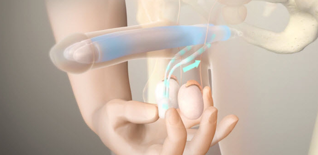 MÉDICO ESPECIALISTA EM IMPLANTE PENIANO EM CURITIBA