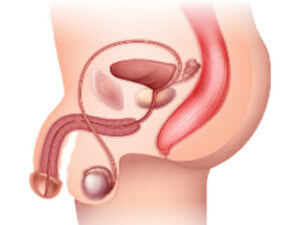 UROLOGISTA EM CURITIBA, LITÍASE URINÁRIA CURITIBA, HIPERPLASIA CURITIBA, TRATAMENTO DE CÂNCER UROLÓGICO CURITIBA, LITOTRIPSIA CURITIBA, PRÓTESE PENIANA CURITIBA, DISFUNÇÃO ERÉTIL EM CURITIBA, INPLANTE PENIANO EM CURITIBA, VARICOCELE EM CURITIBA, EJACULAÇÃO PRECOCE EM CURITIBA, ANDROPAUSA EM CURITIBA, REVISÃO DE VASECTOMIA EM CURITIBA, CURVATURA PENIANA EM CURITIBA, INFERTILIDADE MASCULINA EM CURITIBA, POSTECTOMIA EM CURITIBA, LITÍASE URINÁRIA EM CURITIBA, HIPERPLASIA PROSTÁTICA EM CURITIBA, CÂNCERES UROLÓGICOS EM CURITIBA.