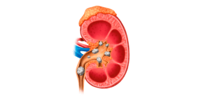 UROLOGISTA EM CURITIBA, LITÍASE URINÁRIA CURITIBA, HIPERPLASIA CURITIBA, TRATAMENTO DE CÂNCER UROLÓGICO CURITIBA, LITOTRIPSIA CURITIBA, PRÓTESE PENIANA CURITIBA, DISFUNÇÃO ERÉTIL EM CURITIBA, INPLANTE PENIANO EM CURITIBA, VARICOCELE EM CURITIBA, EJACULAÇÃO PRECOCE EM CURITIBA, ANDROPAUSA EM CURITIBA, REVISÃO DE VASECTOMIA EM CURITIBA, CURVATURA PENIANA EM CURITIBA, INFERTILIDADE MASCULINA EM CURITIBA, POSTECTOMIA EM CURITIBA, LITÍASE URINÁRIA EM CURITIBA, HIPERPLASIA PROSTÁTICA EM CURITIBA, CÂNCERES UROLÓGICOS EM CURITIBA.