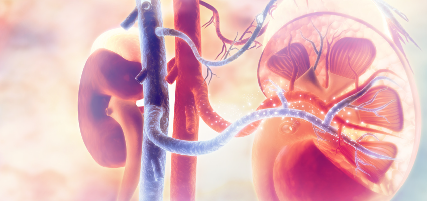calculo-renal-e-o-tratamento-com-a-nefrolitotripsia-curitiba NEFROLITOTRIPSIA PERCUT NEA E MINI PERCUTÂNEA